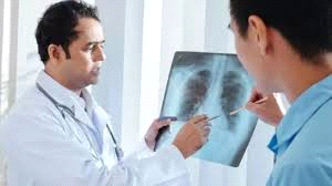 देश में टीबी के नए मामलों में 21 प्रतिशत की गिरावट, वैश्विक गिरावट से दोगुनी